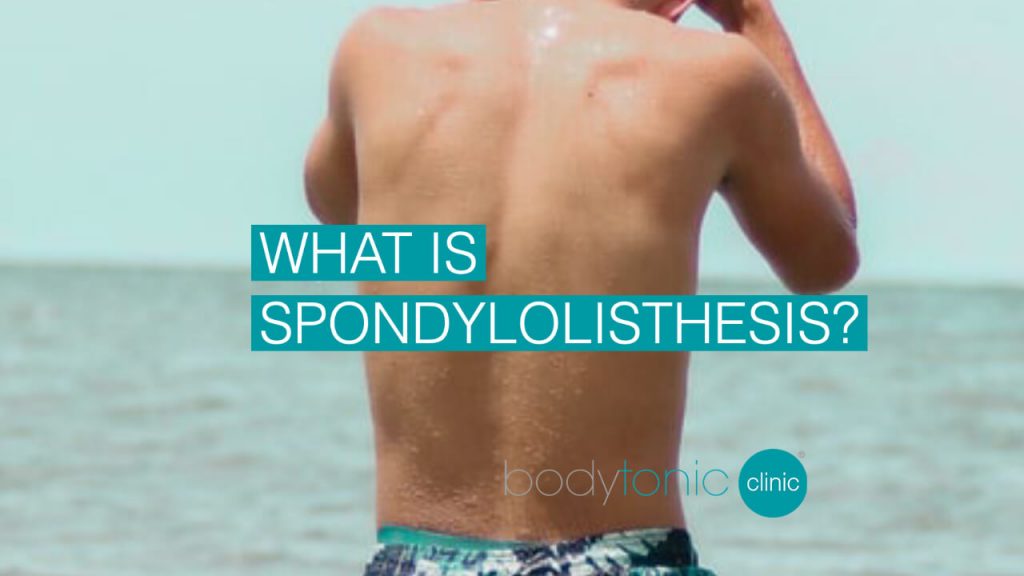 Spondylolisthesis bodytonic clinic SE16