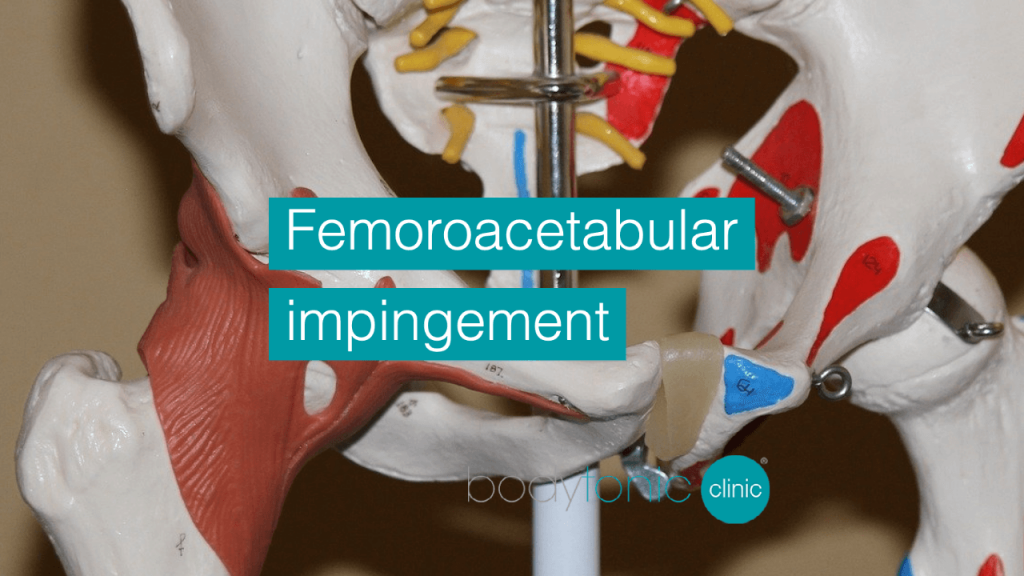 Femoroacetabular impingement bodytonic clinic London