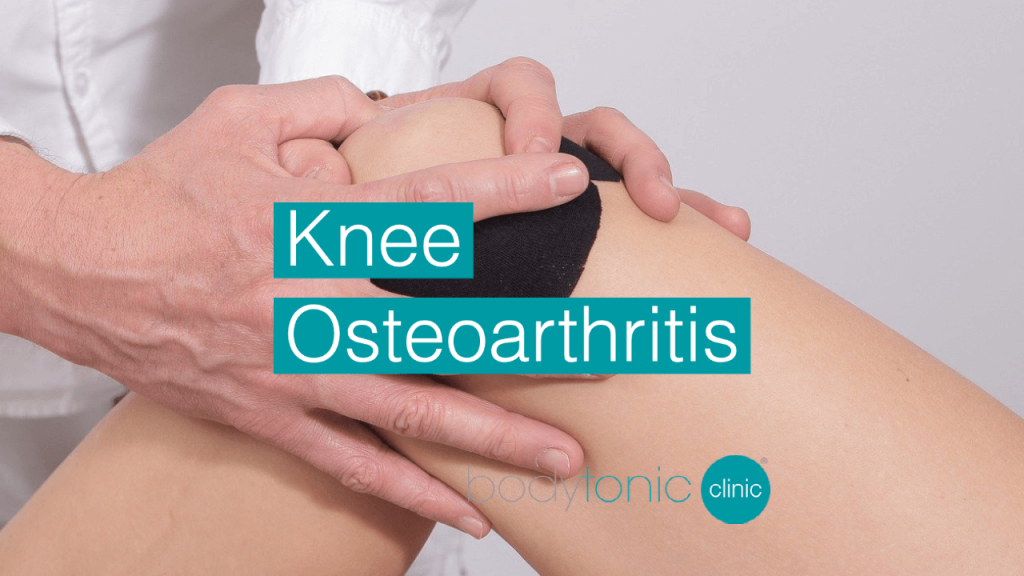 Knee Osteoarthritis bodytonic clinic London