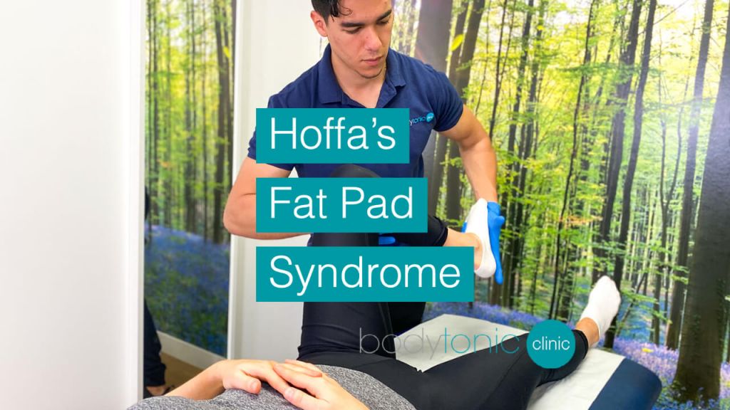 Hoffa’s Fat Pad Syndrome bodytonic clinic SE16 London Canada Water Stratford E15 E20 E14