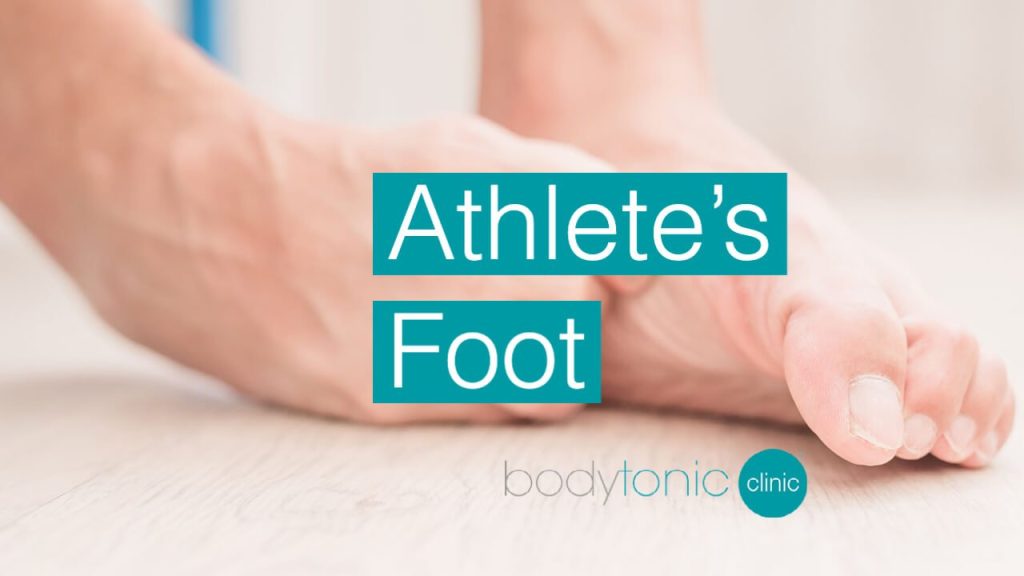 Athletes Foot London bodytonic clinic SE16