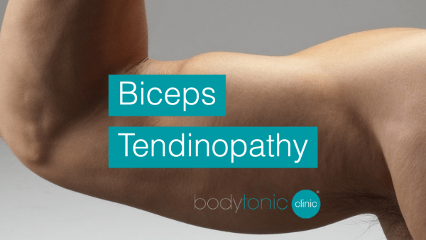 biceps tendinopathy