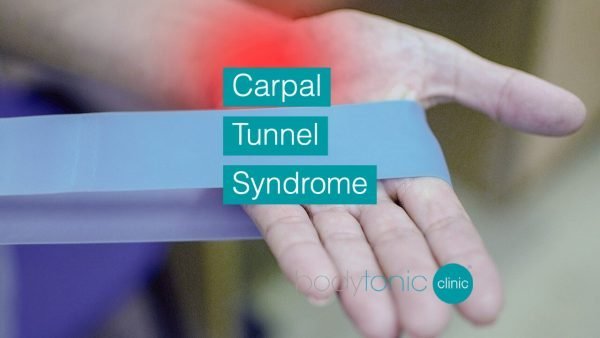 carpal tunnel syndrome