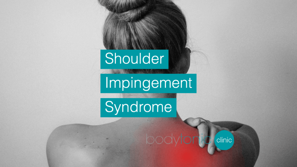 Shoulder Impingement Syndrome bodytonic clinic SE16 london