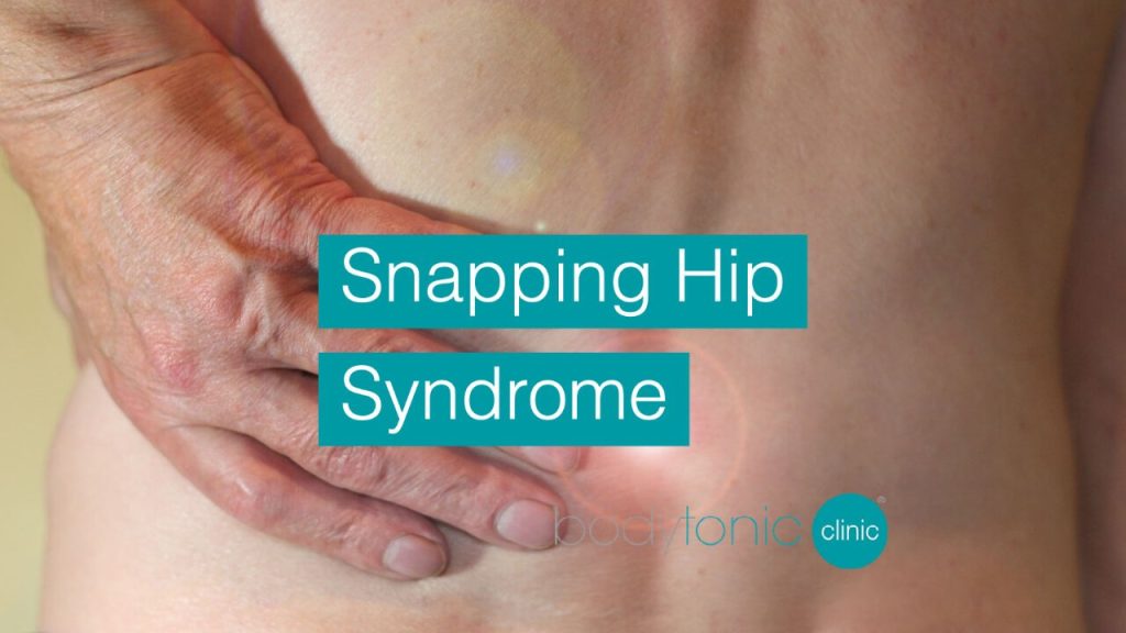 snapping hip syndrome