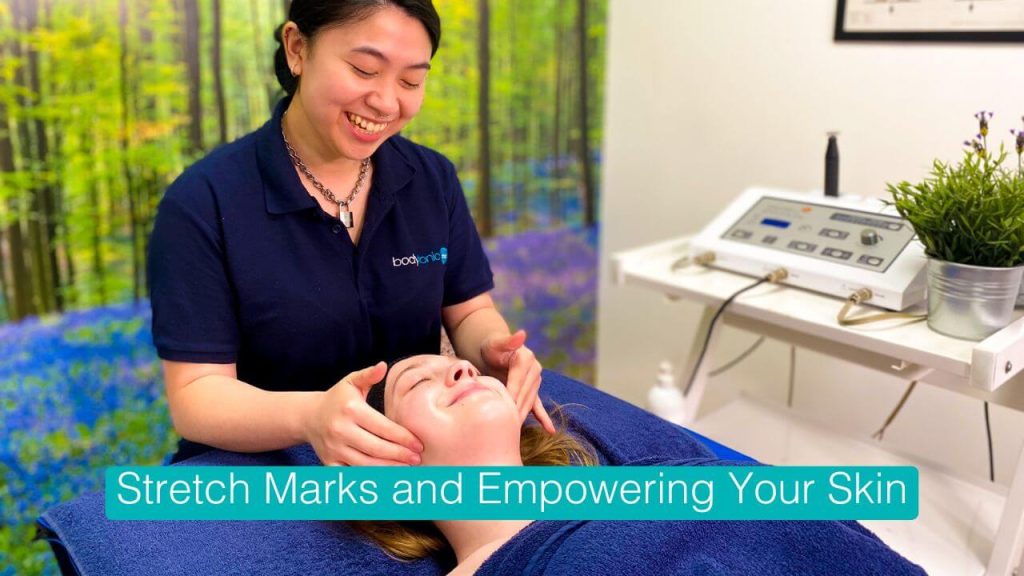 A professional treatment designed to reduce the appearance of stretch marks and improve skin elasticity.