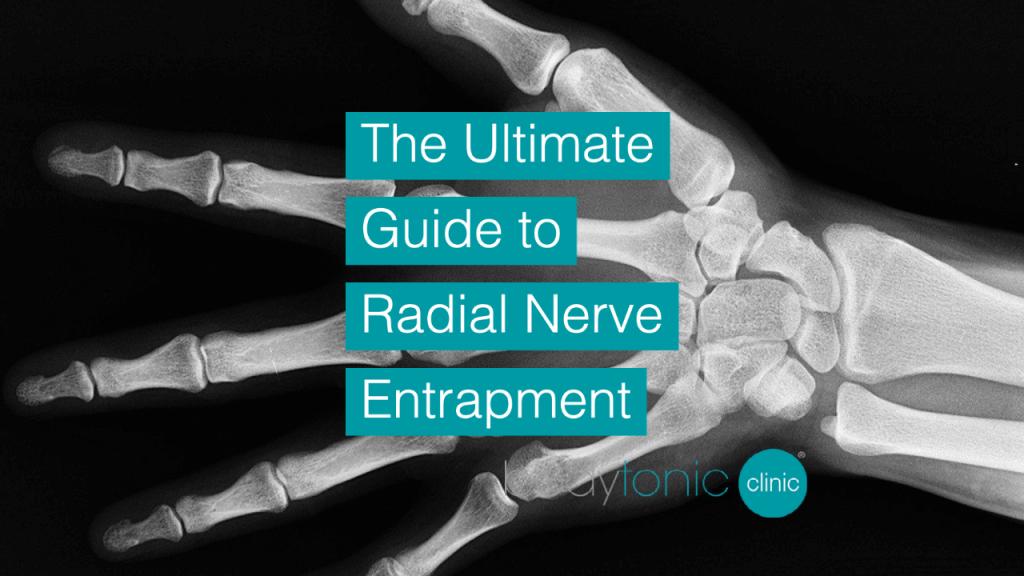 The Ultimate Guide to Radial Nerve bodytonic clinic SE16 London