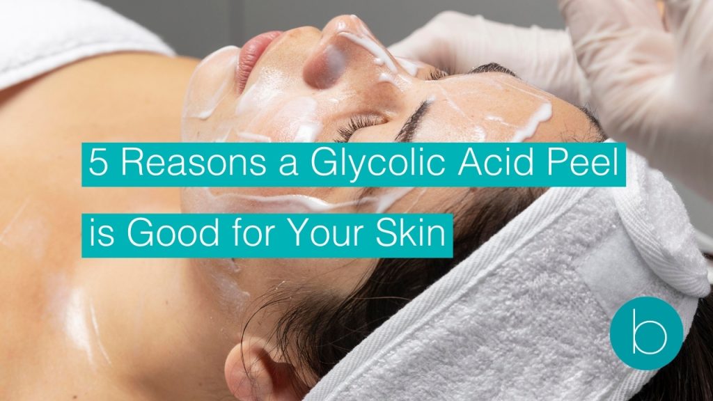5 reasons a glycolic acid peel is good for your skin