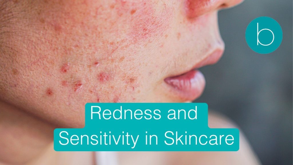 redness-sensitivity-skincare-guide-london