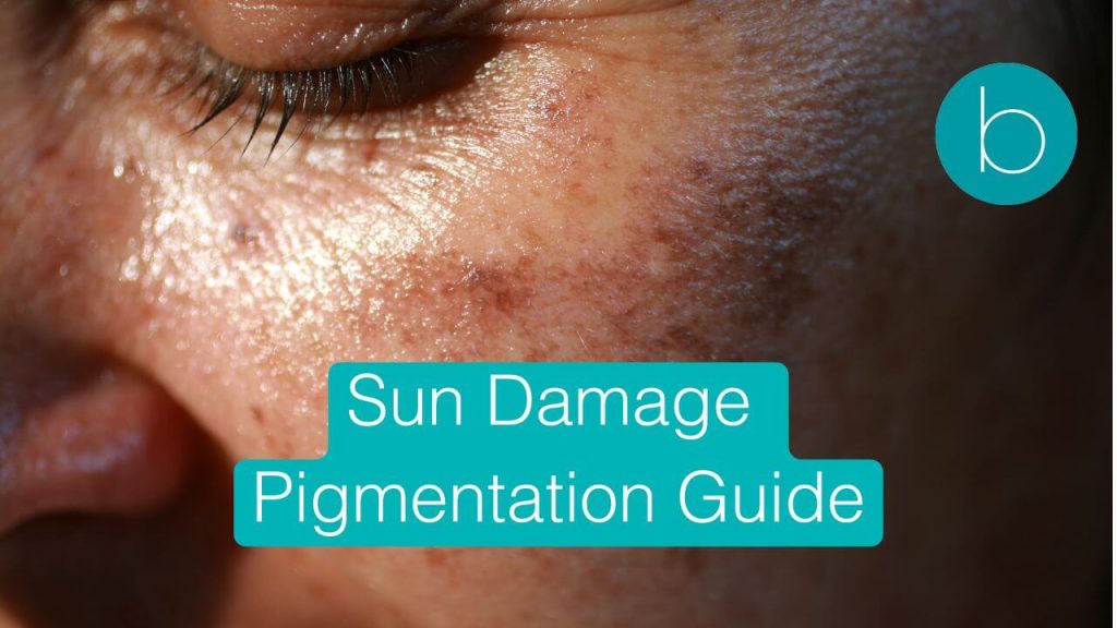 sun-damage-pigmentation-guide-london-canada-water SE16-stratford E15