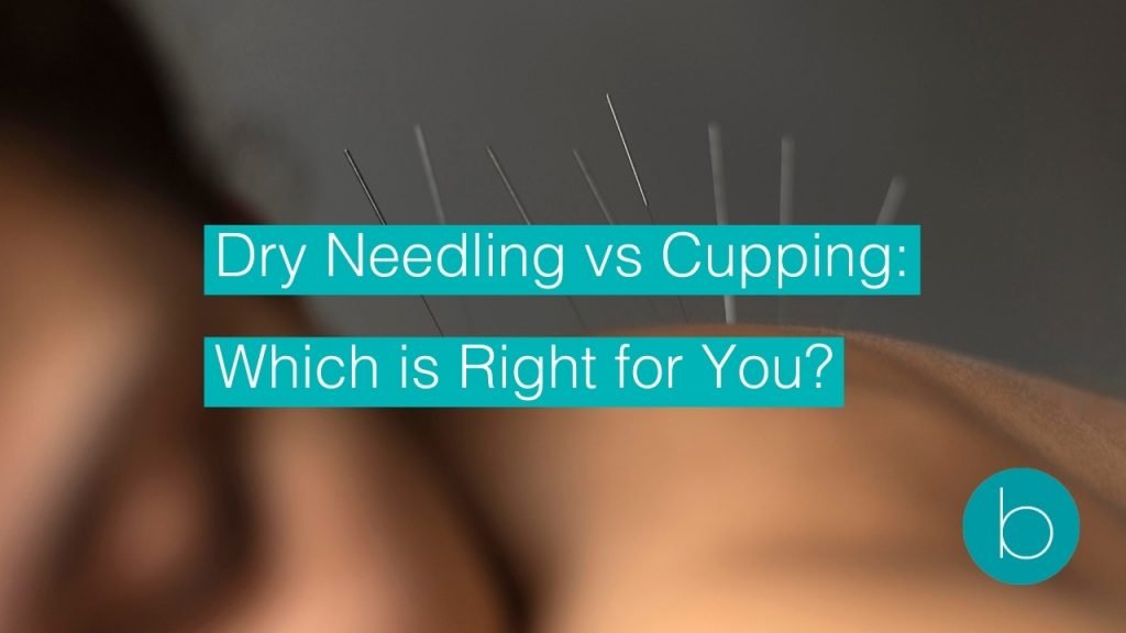 dry needling vs cupping