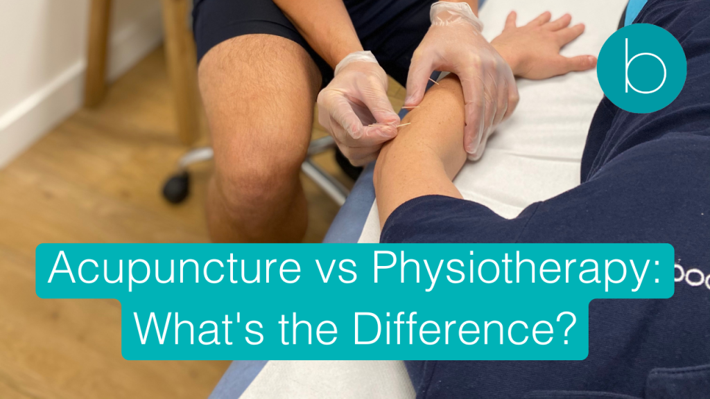 Acupuncture vs Physiotherapy