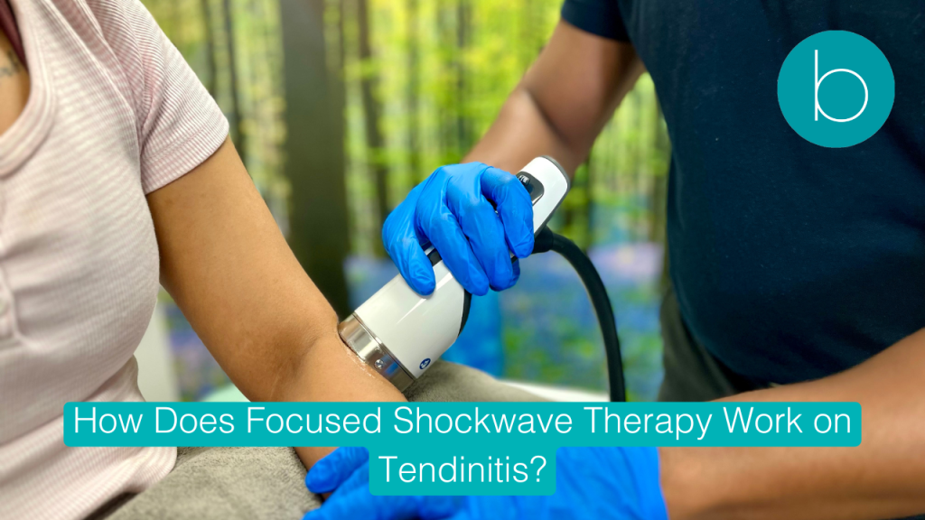 Focus shockwave therapy on tendinitis