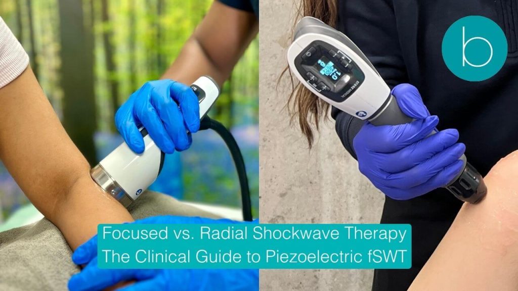 Focused vs. Radial Shockwave Therapy The Clinical Guide to Piezoelectric fSWT